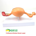 SELL 12442 Uterine Structure Anatomical Model Anatomy Reproductive System